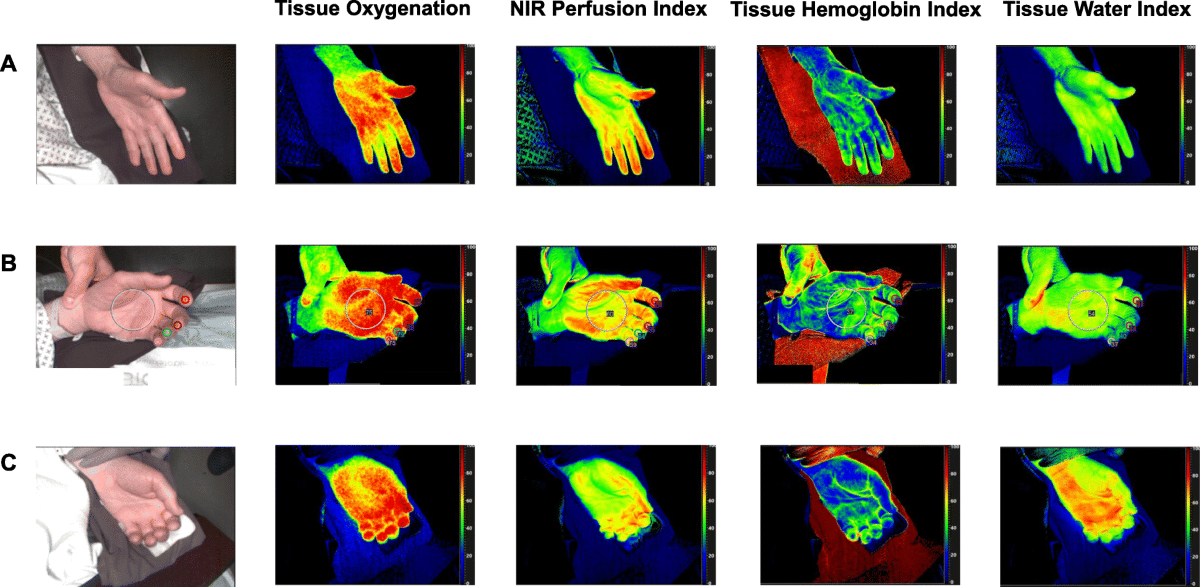 SWIR application image for biomedical imaging, fluorescence, and research